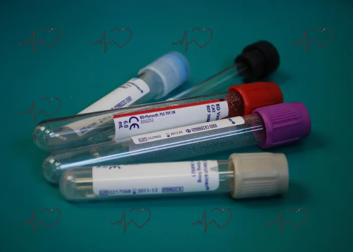 Different colored blood collection tubes used for medical testing.